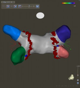 AF ablation lesion set